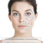 restylane soft restoration chirurgo plastico napoli