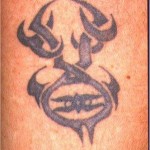 asportazione tatuaggio con laser q-switched